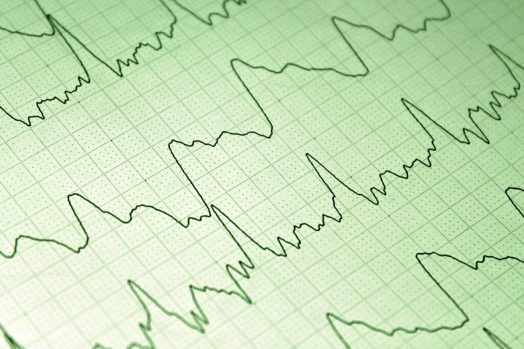 商談におけるクロージングのためのSaaS活用方法は？
