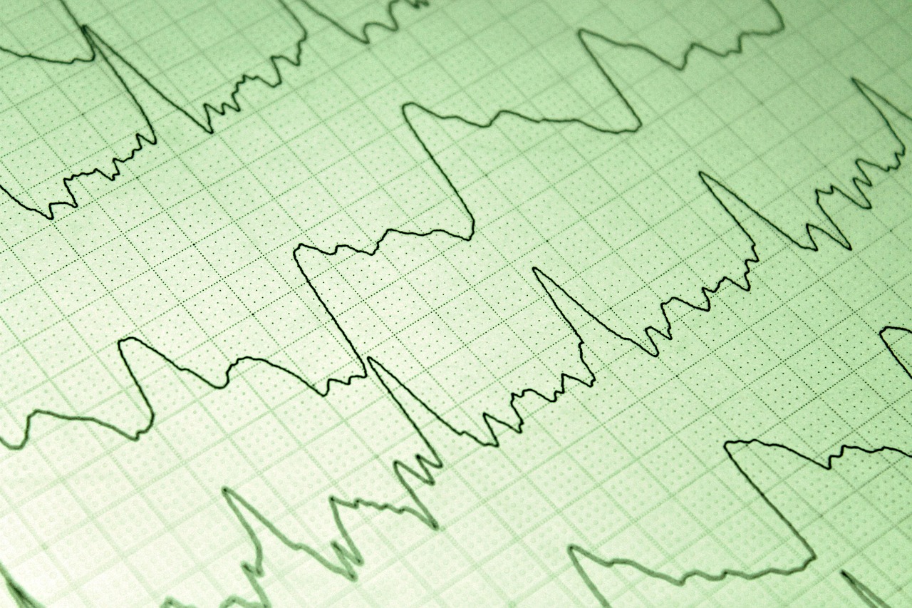 商談におけるクロージングのためのSaaS活用方法は？